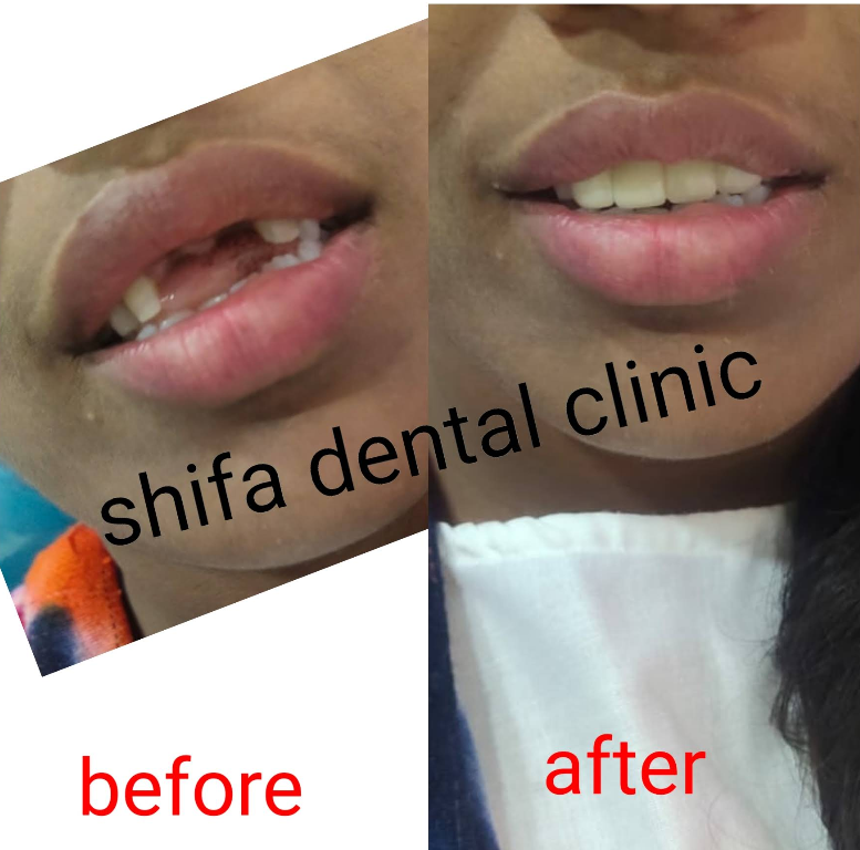 Comprehensive dental checkups